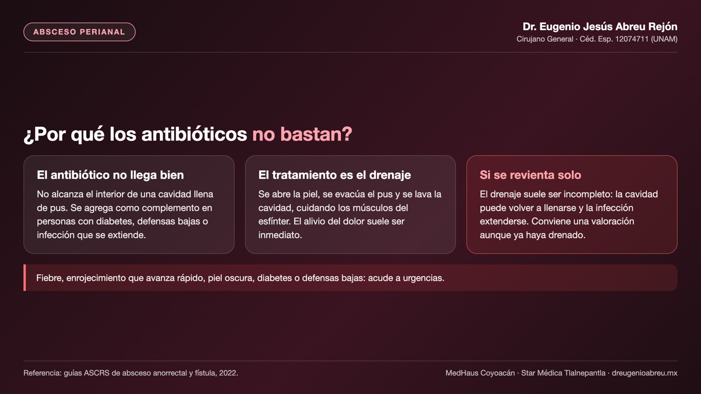 Lámina: por qué los antibióticos no bastan en el absceso perianal y qué pasa si se revienta solo