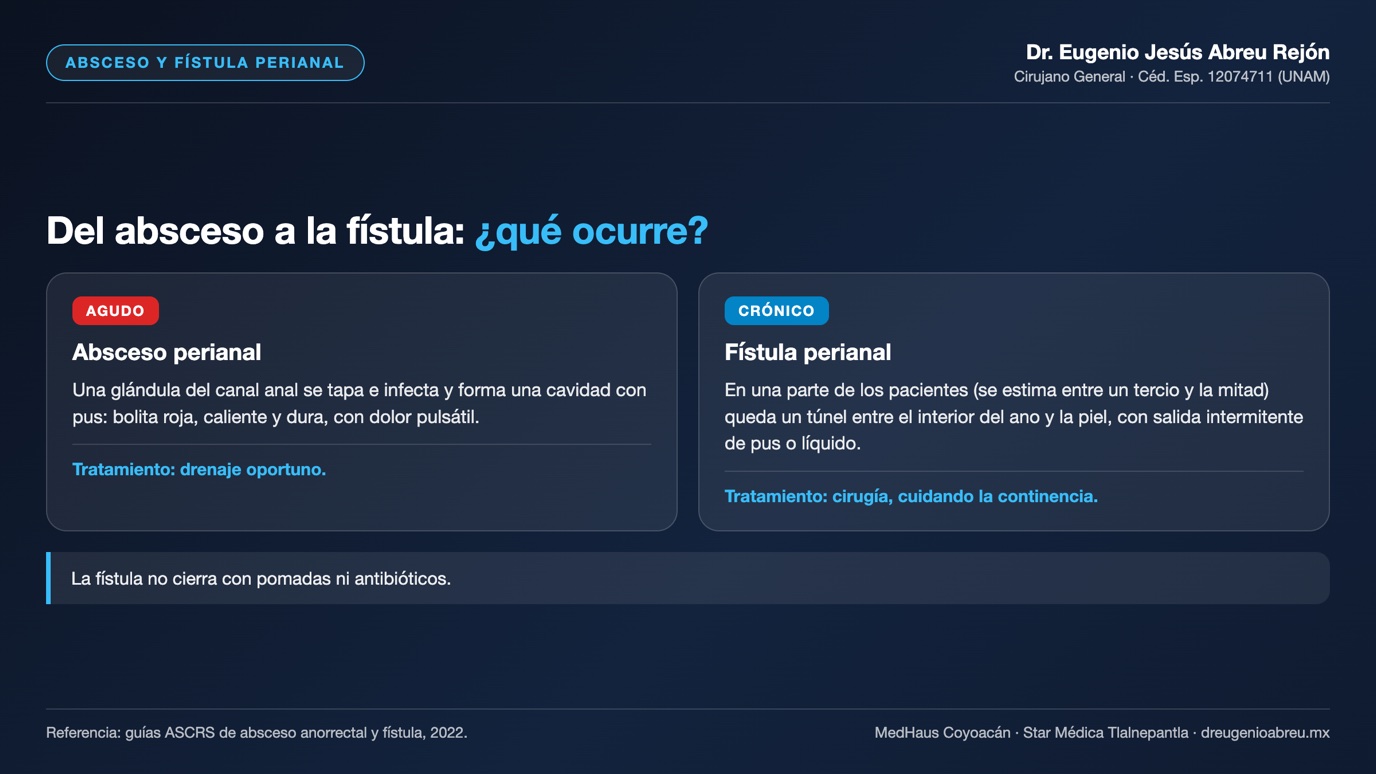 Lámina: del absceso perianal agudo a la fístula perianal crónica