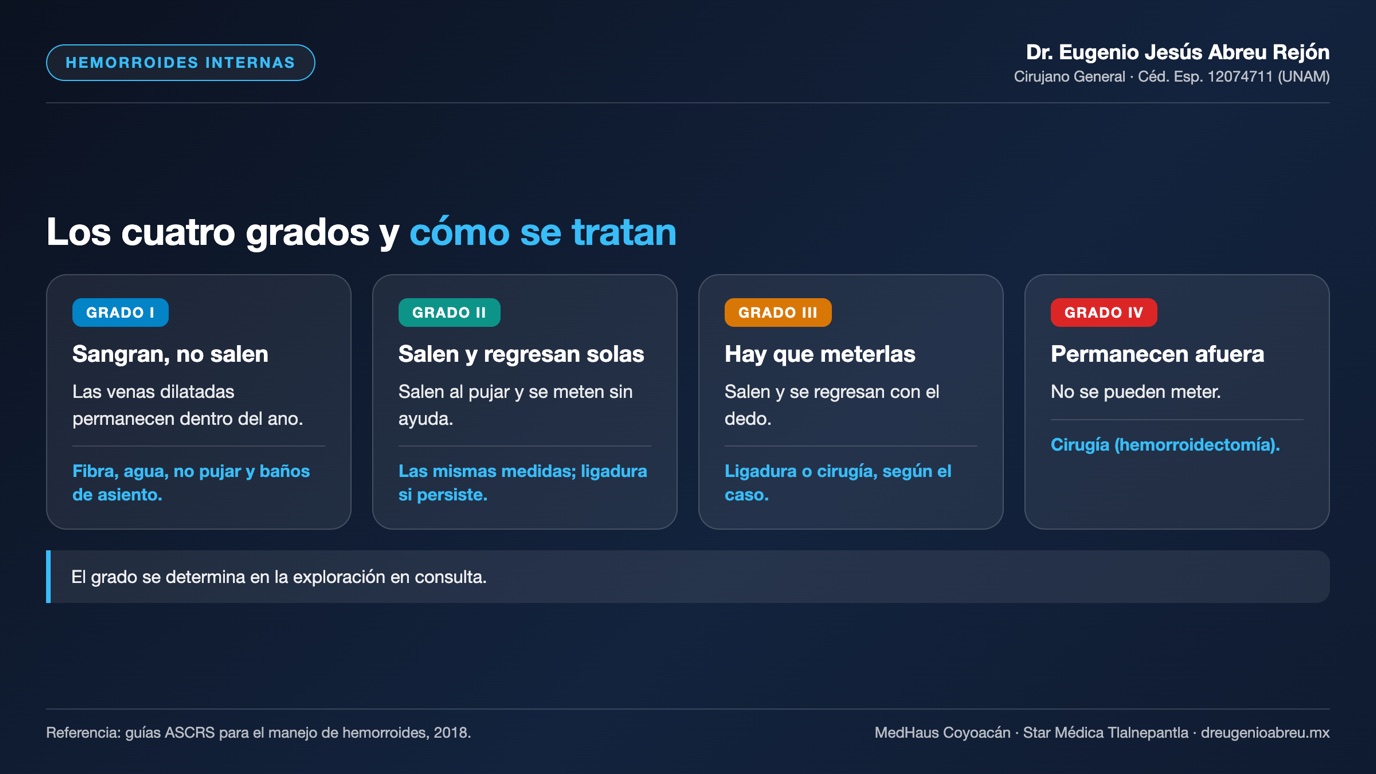 Lámina: los cuatro grados de las hemorroides internas y su tratamiento habitual