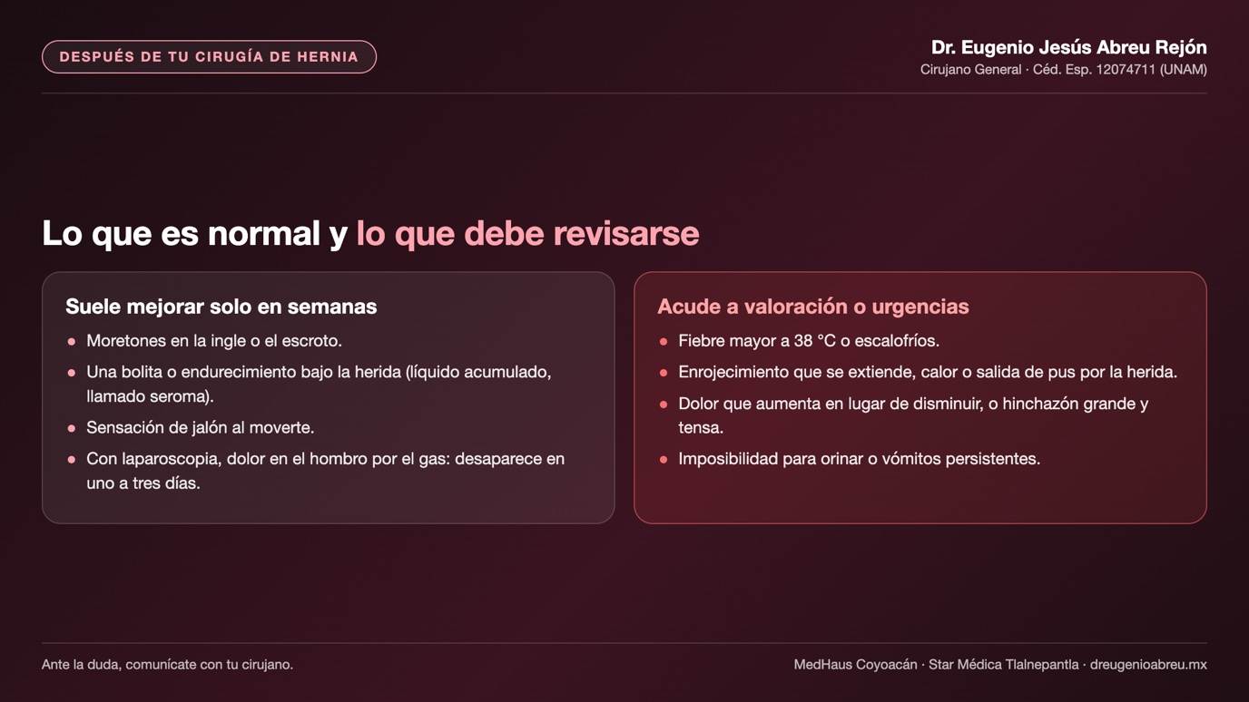 Lámina: molestias normales y señales de alarma después de la cirugía de hernia inguinal