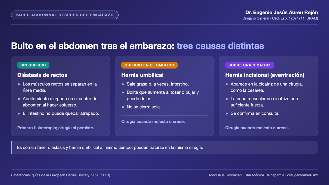 Lámina comparativa: diástasis de rectos, hernia umbilical y hernia incisional sobre la cicatriz de la cesárea