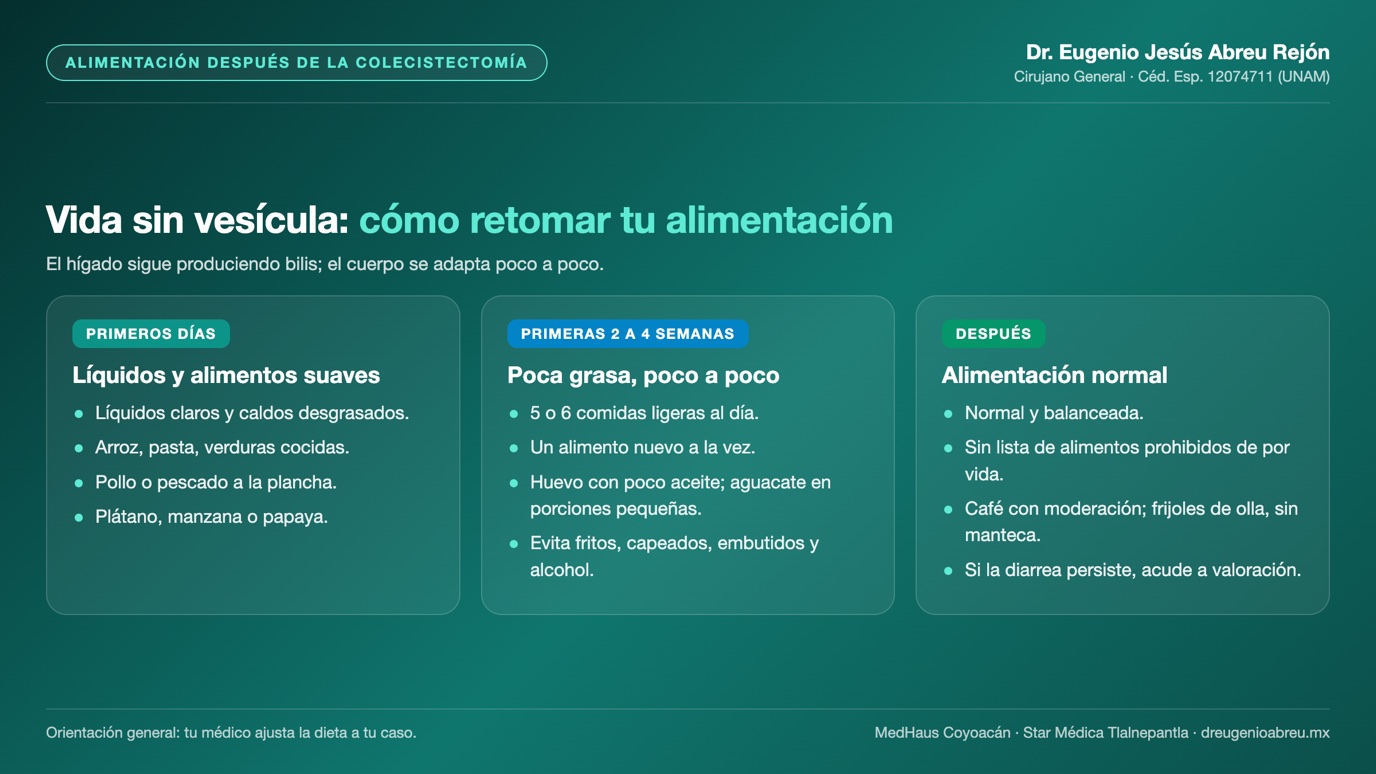 Lámina: alimentación después de la colecistectomía en los primeros días, las primeras 2 a 4 semanas y después