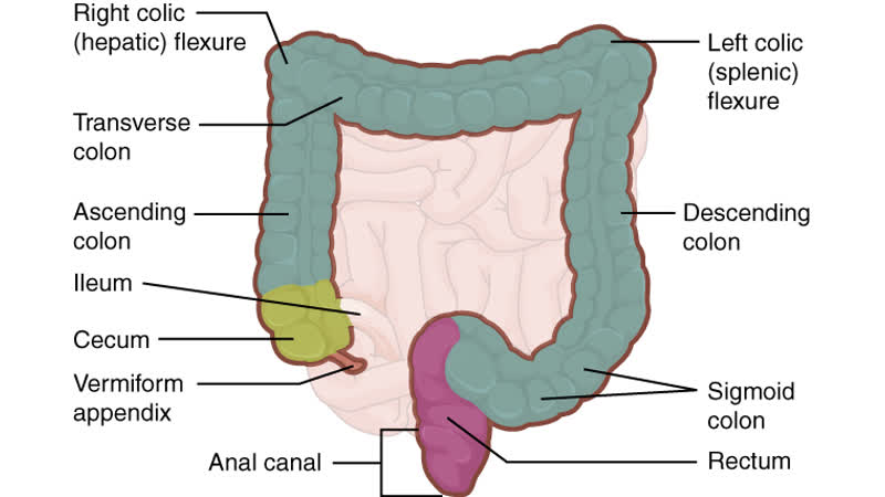 Enfermedad Diverticular de Colon